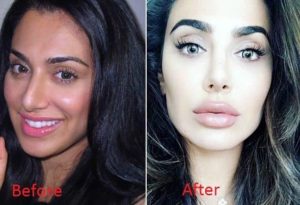 Huda before and after transformation